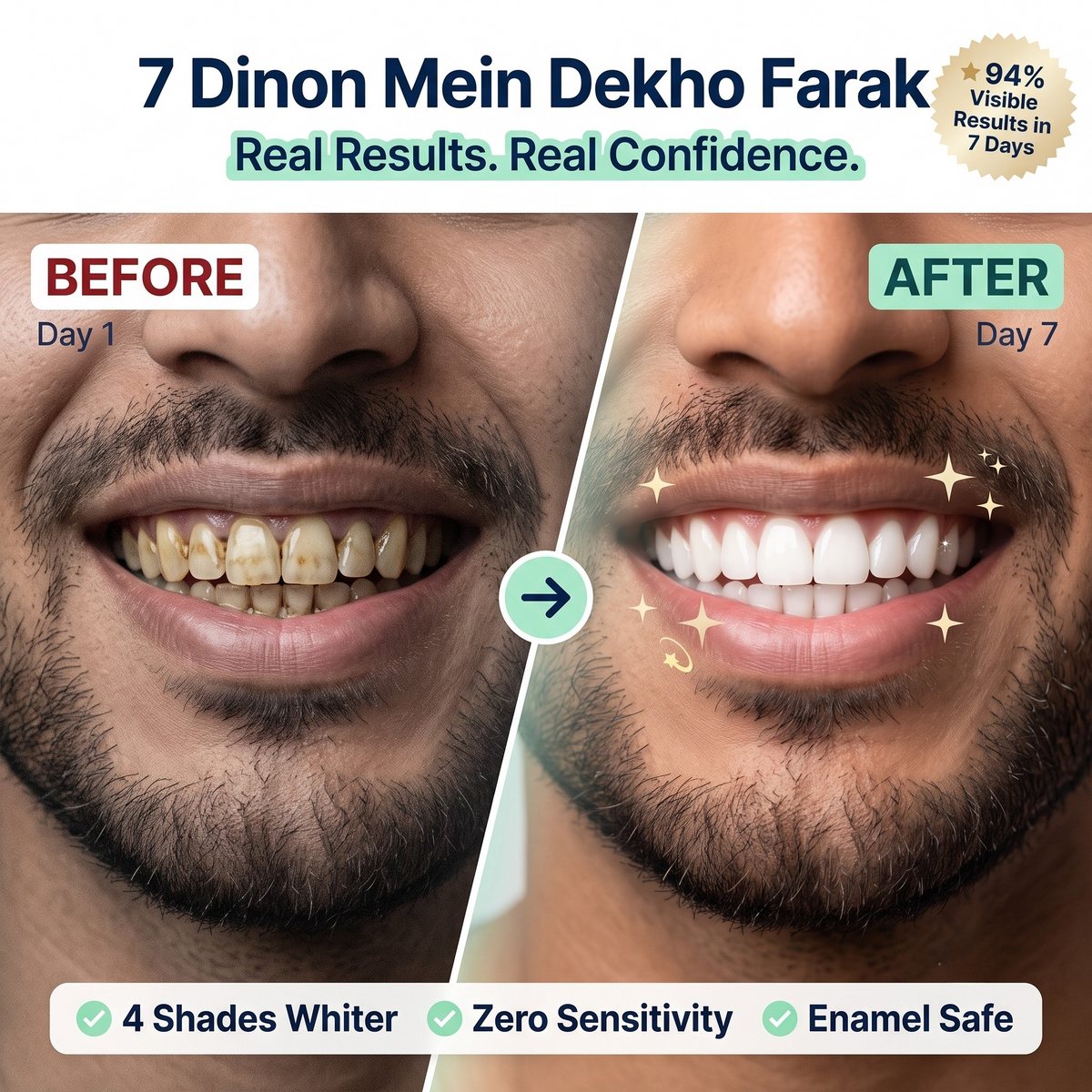 PearlFix™ Teeth Whitening Gel Instant Yellow Stain Remover