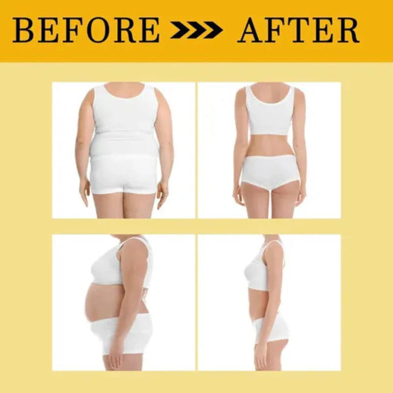 Bee Venom Drainage & Slimming Belly Patches (BUY 1 GET 1 FREE)
