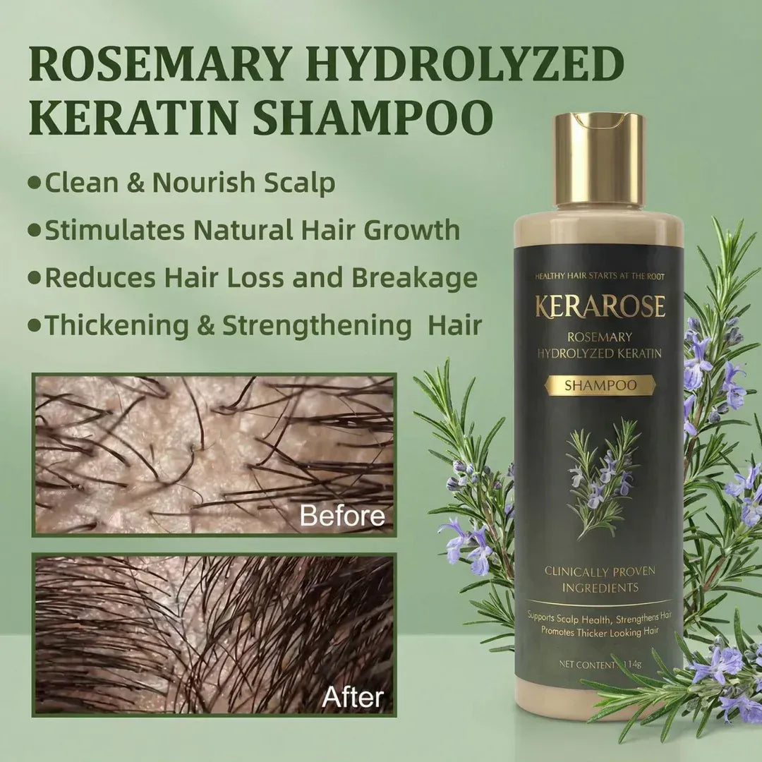 Kerarose Rosemary Shampoo For Hair Growth (MALE & FEMALE)