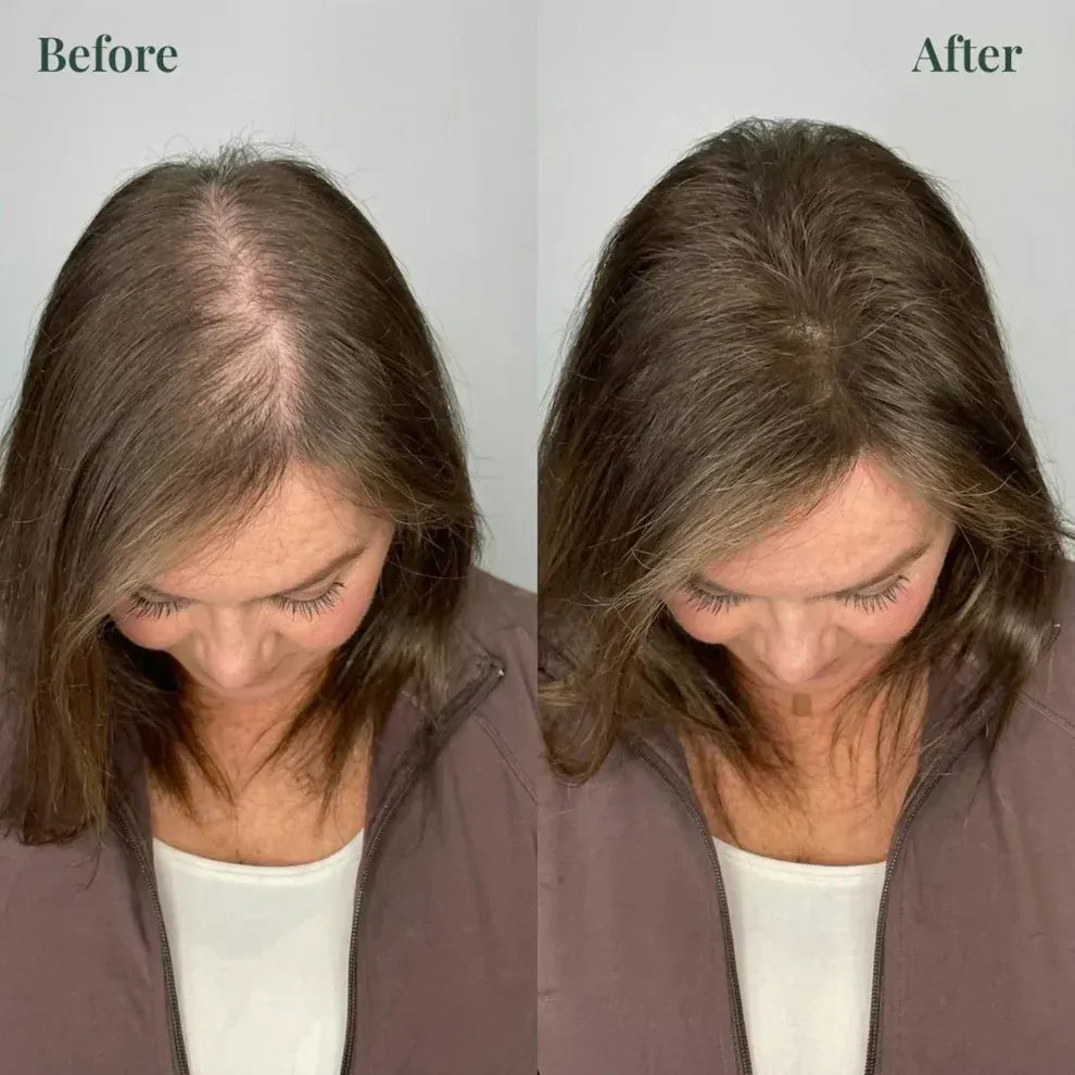 Kerarose Rosemary Shampoo For Hair Growth (MALE & FEMALE)